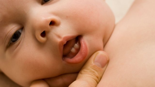 Uşaqlarda diş çıxarma dövrü necə keçir?