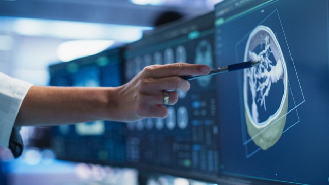 Qan xərçənginin inkişafına mane olan zülallar tapıldı - İlk dəfə