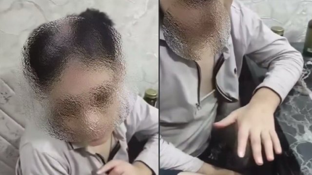 Qəyyumluğa verilən 14 yaşlı yeniyetməyə işgəncə verildi: Bəs ona kim nəzarət edirdi?