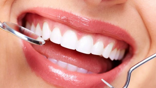 Dişləri təbii yolla da ağartmaq mümkündür?