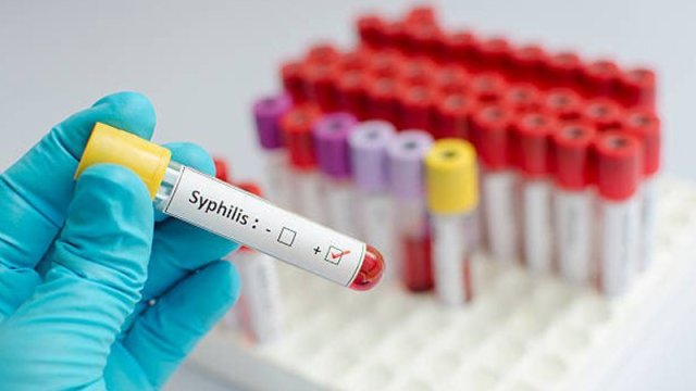 Uşaqlar necə olur sifilisə yoluxur?