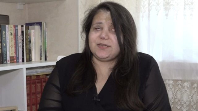 Gəncə terrorunda gözlərini itirən qadın başına gələnləri danışdı: "Qoymayın ölüm, qızlarım var"