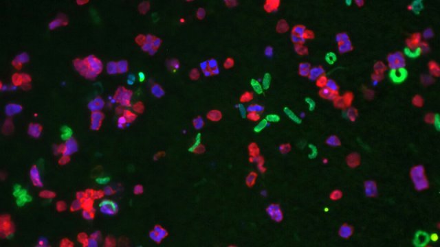 Alimlər: Mikroblar raket buraxılışı və kosmos uçuşundan sağ çıxa bilir