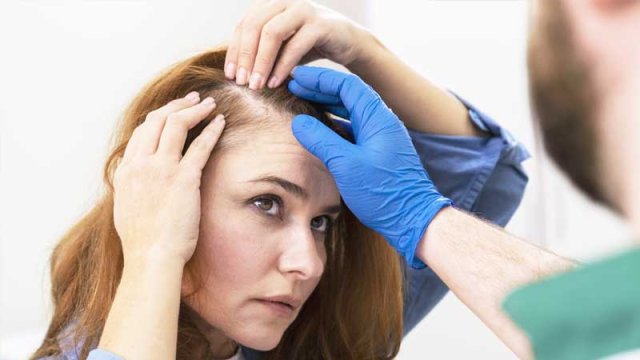 Saç tökülməsinin müalicəsində gözlənilməz üsul tapıldı