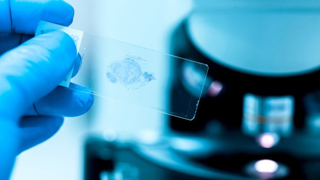 Hüceyrələrin qocalmasının yeni mümkün səbəbi tapıldı