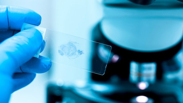 B2 vitamini xərçəng hüceyrələrinin ölümünə qarşı qoruyucu ola bilər - Alimlər