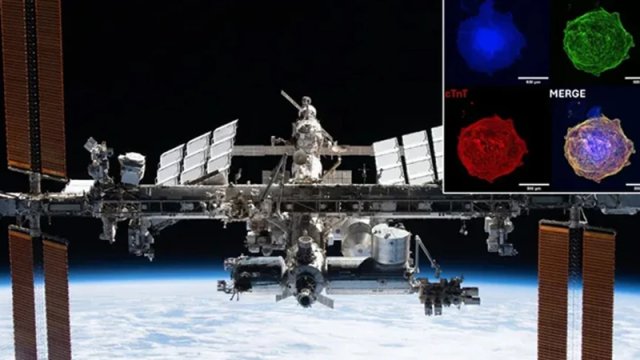 Ürək köçürülməsində yeni ümid: Dünyada olmayan imkan kosmosda tapıldı