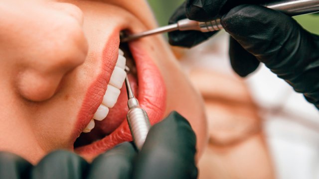 Stomatoloq irsi keçə bilən diş problemlərindən danışdı