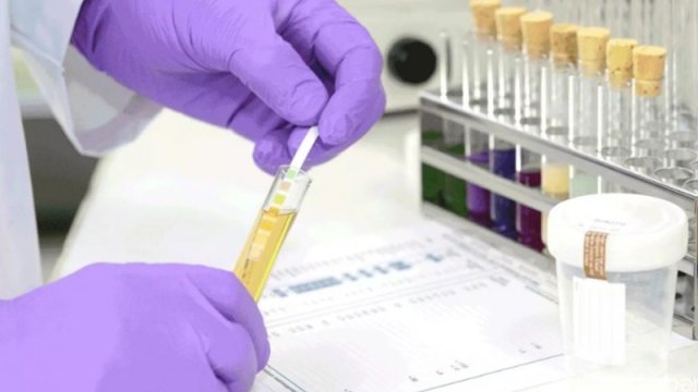 Nikahdan əvvəl cütlüklər narkoloji testdən keçməlidir?